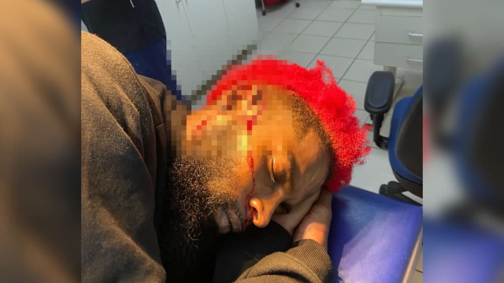 Jovem diz ter sido vítima de racismo em Florianópolis: “tô com medo de ficar surdo”