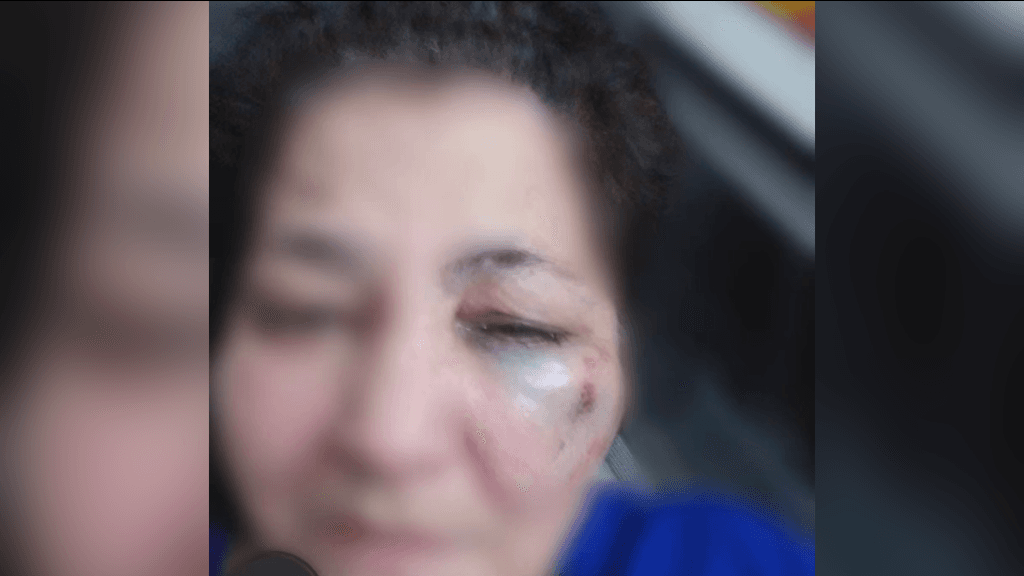 Idosa é brutalmente espancada por filha e genro