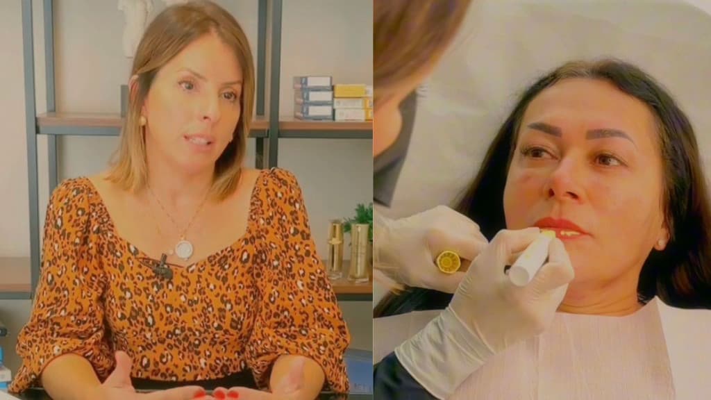 Preenchimento Labial: esteticista revela os segredos para uma boca perfeita