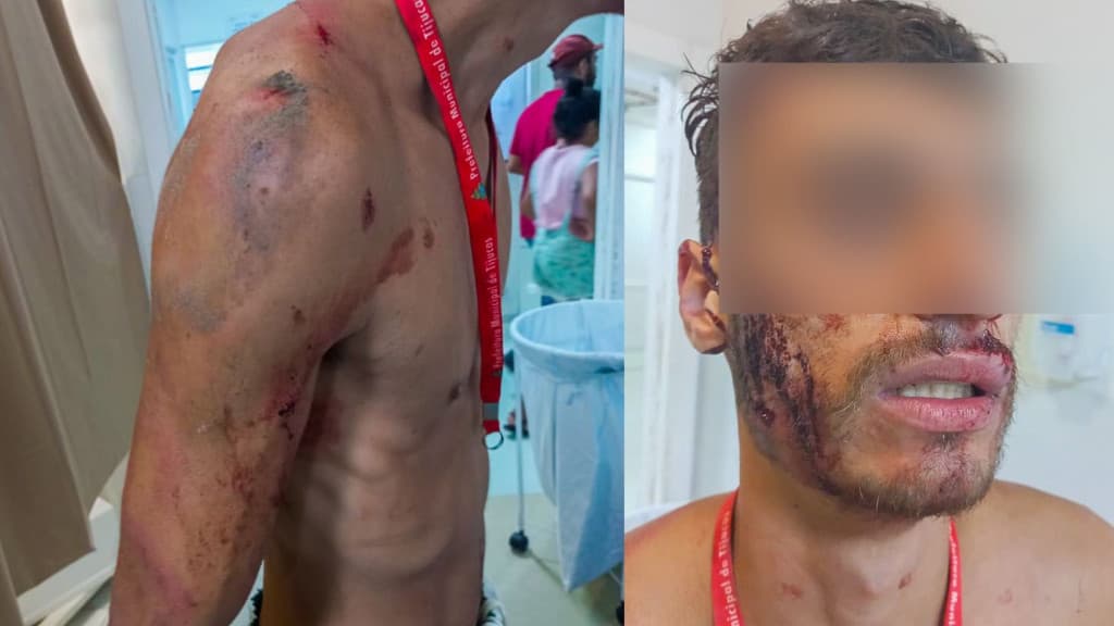 Moradores revoltados espancam acusado de furtar bicicleta, em Itapema