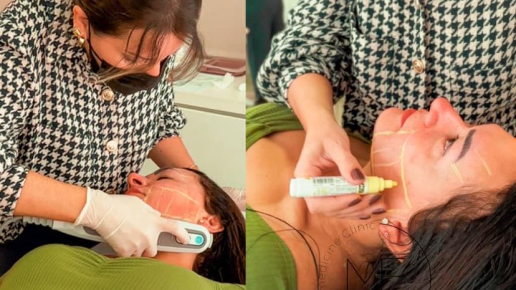 “Ultrassom Microfocado”: descubra os impressionantes benefícios para a sua pele