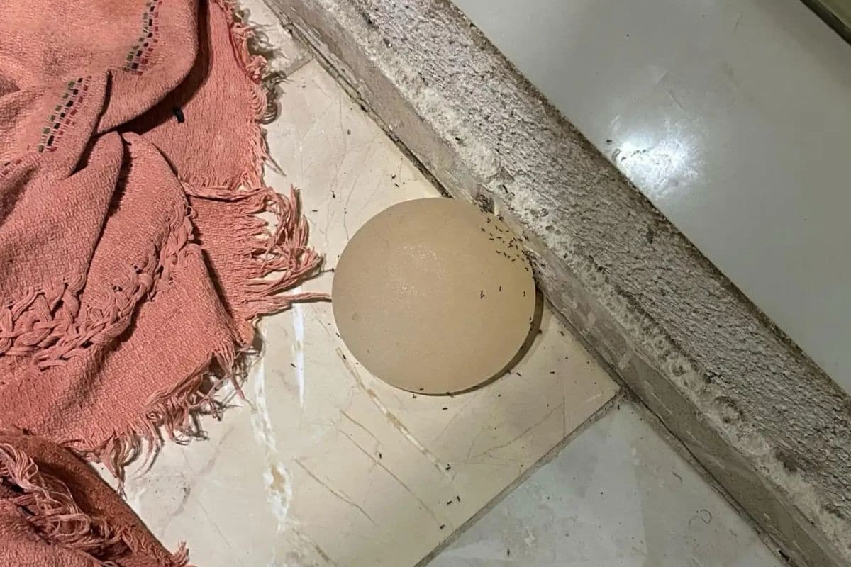 Arrancou o silicone com faca: homem agride esposa recém-operada