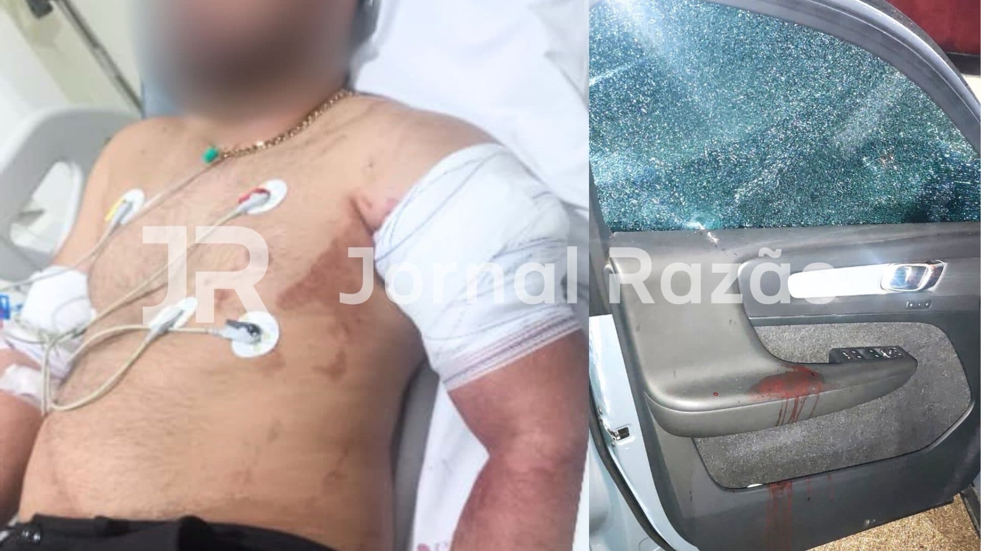 TIJUCAS: Motorista escapa da morte após ser baleado ao sofrer emboscada de ladrões