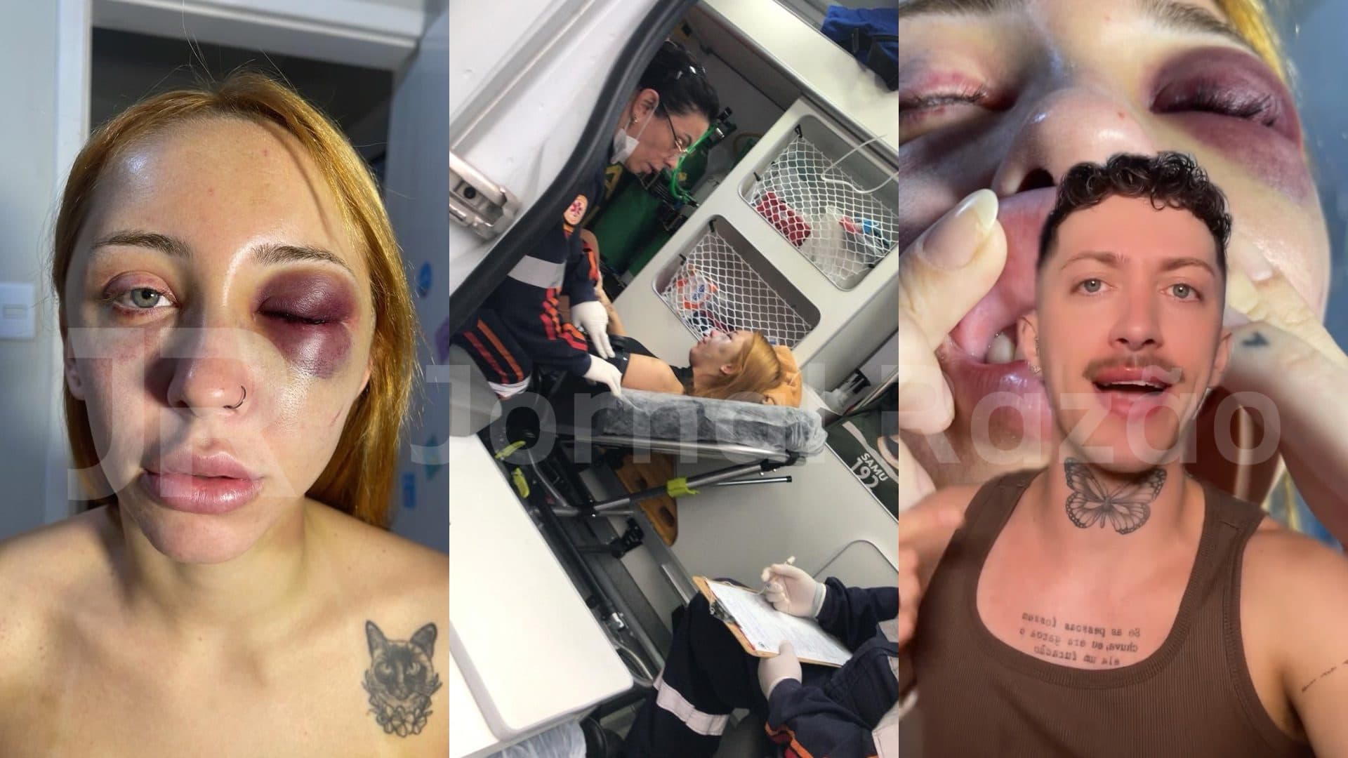 “Eu mereci”: jovem de SC escapa da morte e defende agressor, mas família denuncia sequestro e tortura