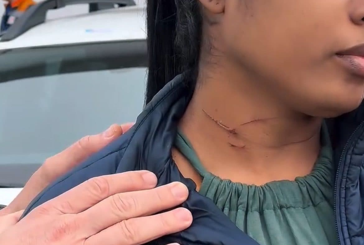 Moradora de Itajaí quase tem pescoço arrancado por pipa com cerol