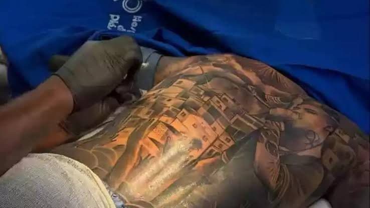 Após tragédia em Itapema, Brasil proíbe uso de anestesia para tatuagens