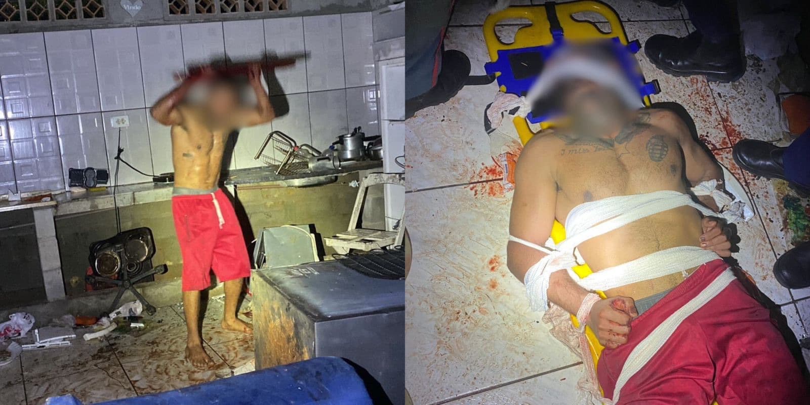 Alerta em SC: jovem tem surto psicótico em Florianópolis após uso de cocaína