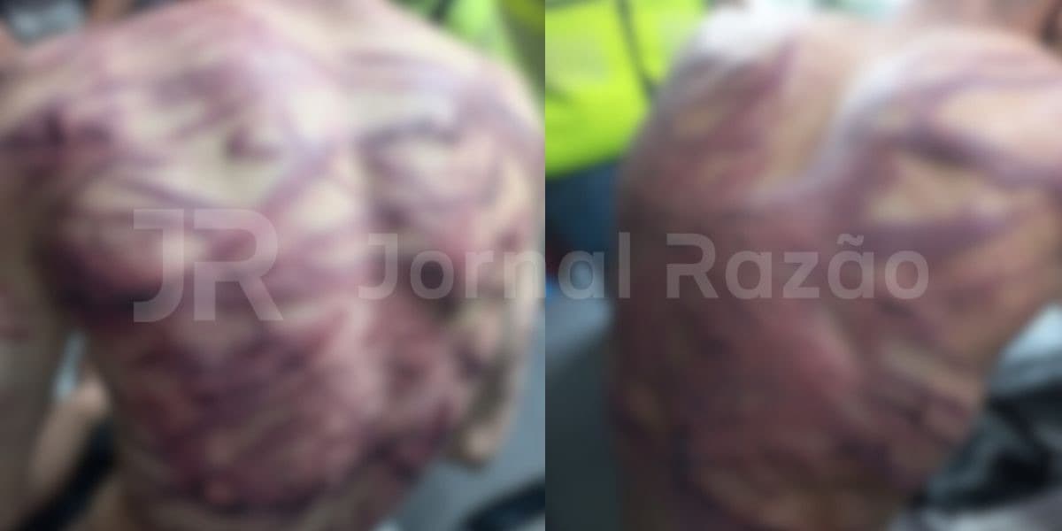 Mistério em Porto Belo: jovem e padrasto com diversas passagens são brutalmente espancados