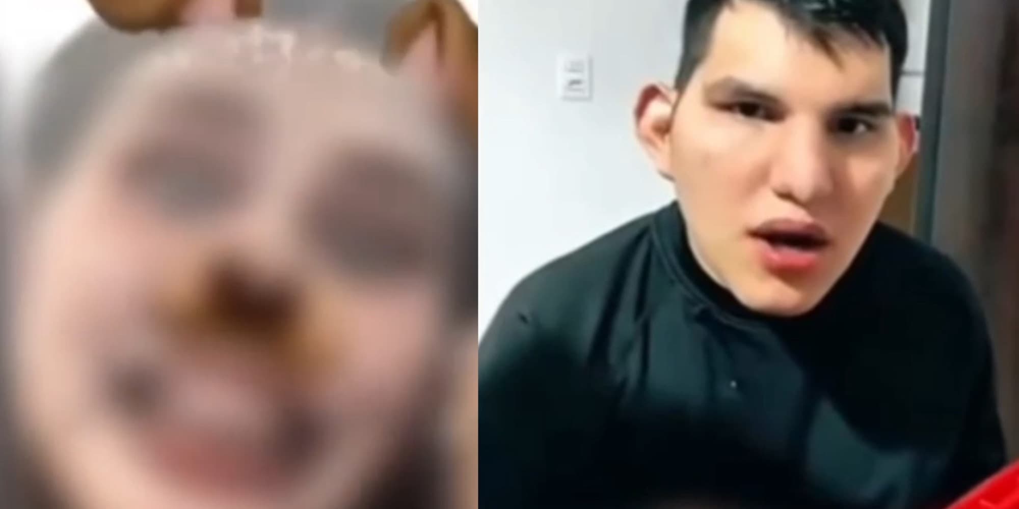 Durante live: adolescentes imitam e debocham de jovem com deficiência rara e geram indignação em SC