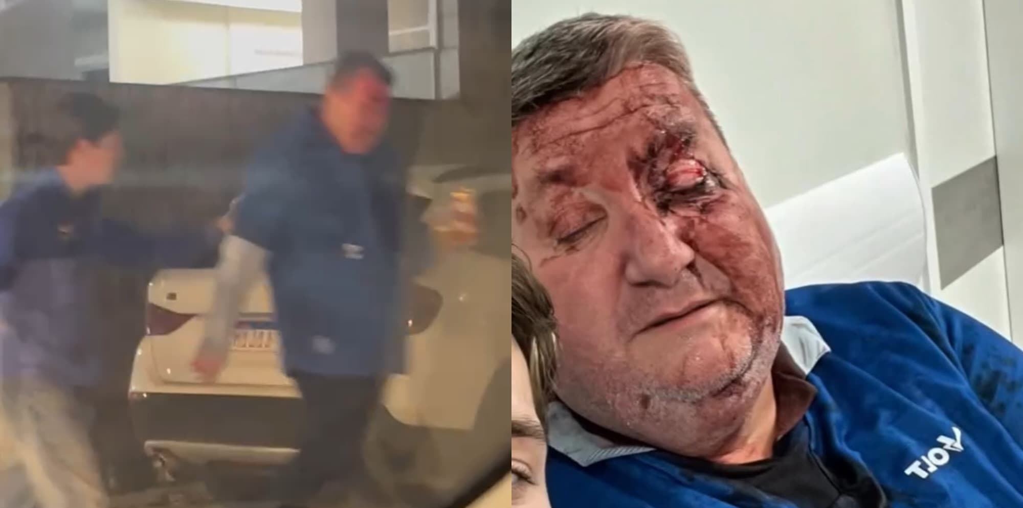 Pai e filho são espancados em Florianópolis na saída do clássico “Avaí x Figueirense”