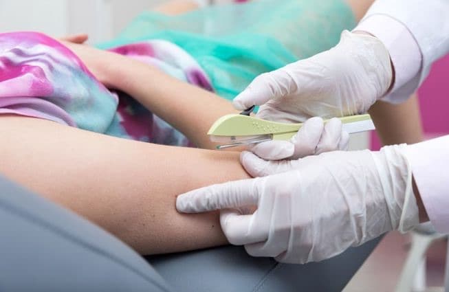 SC terá implante contraceptivo gratuito: Florianópolis, Tijucas e BC estão entre as cidades selecionadas