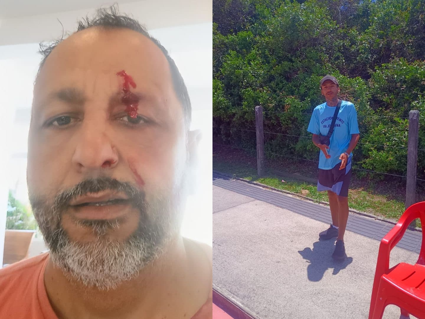 Motorista diz ter sido agredido após se recusar a pagar flanelinha em praia de Florianópolis 