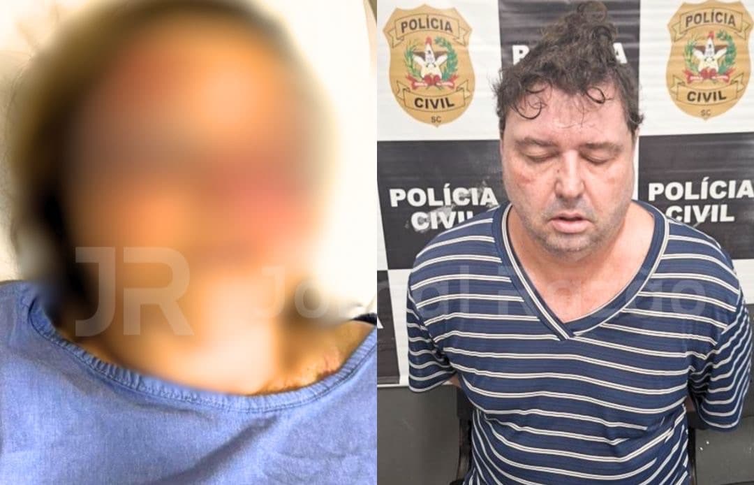 Filho espanca a própria mãe de 83 anos em Florianópolis por motivo inacreditável