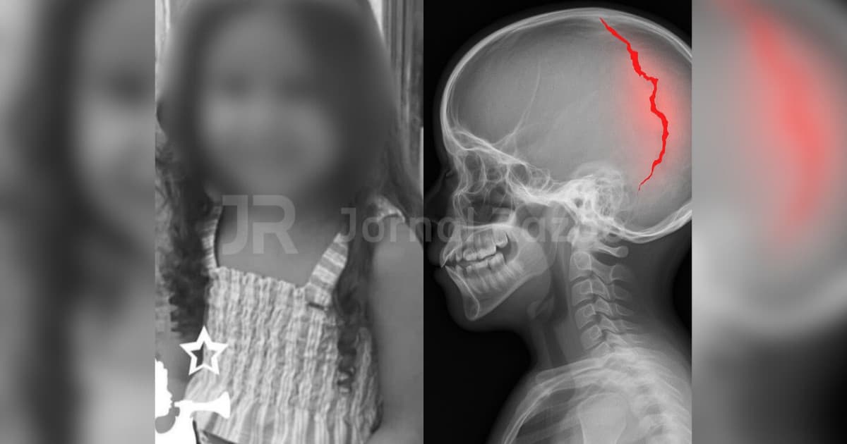 “Cachorro empurrou”: morre menina de 4 anos levada ao hospital pelo padrasto em SC