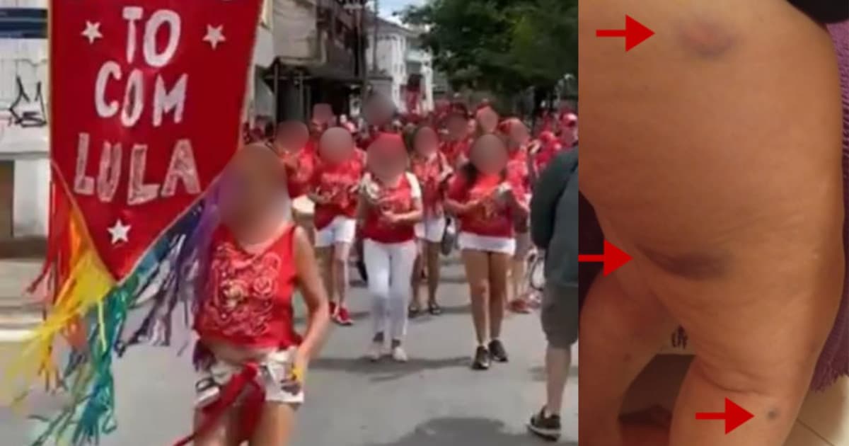 Do alto, morador de Florianópolis dá tiros de chumbinho em membros do bloco de samba “Tô com Lula”