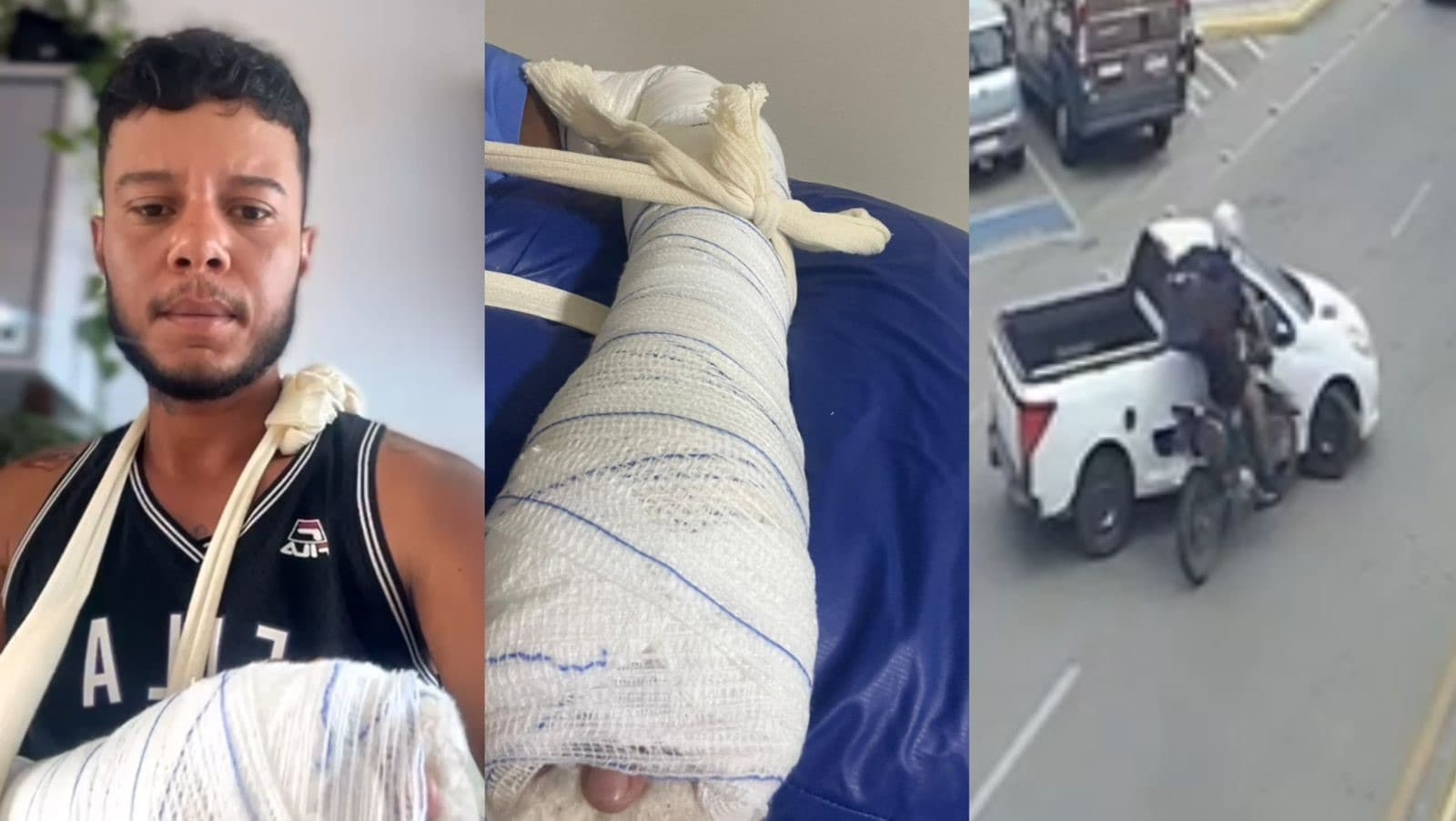 Motoboy sofre fratura exposta após ter frente cortada por carro em Tijucas