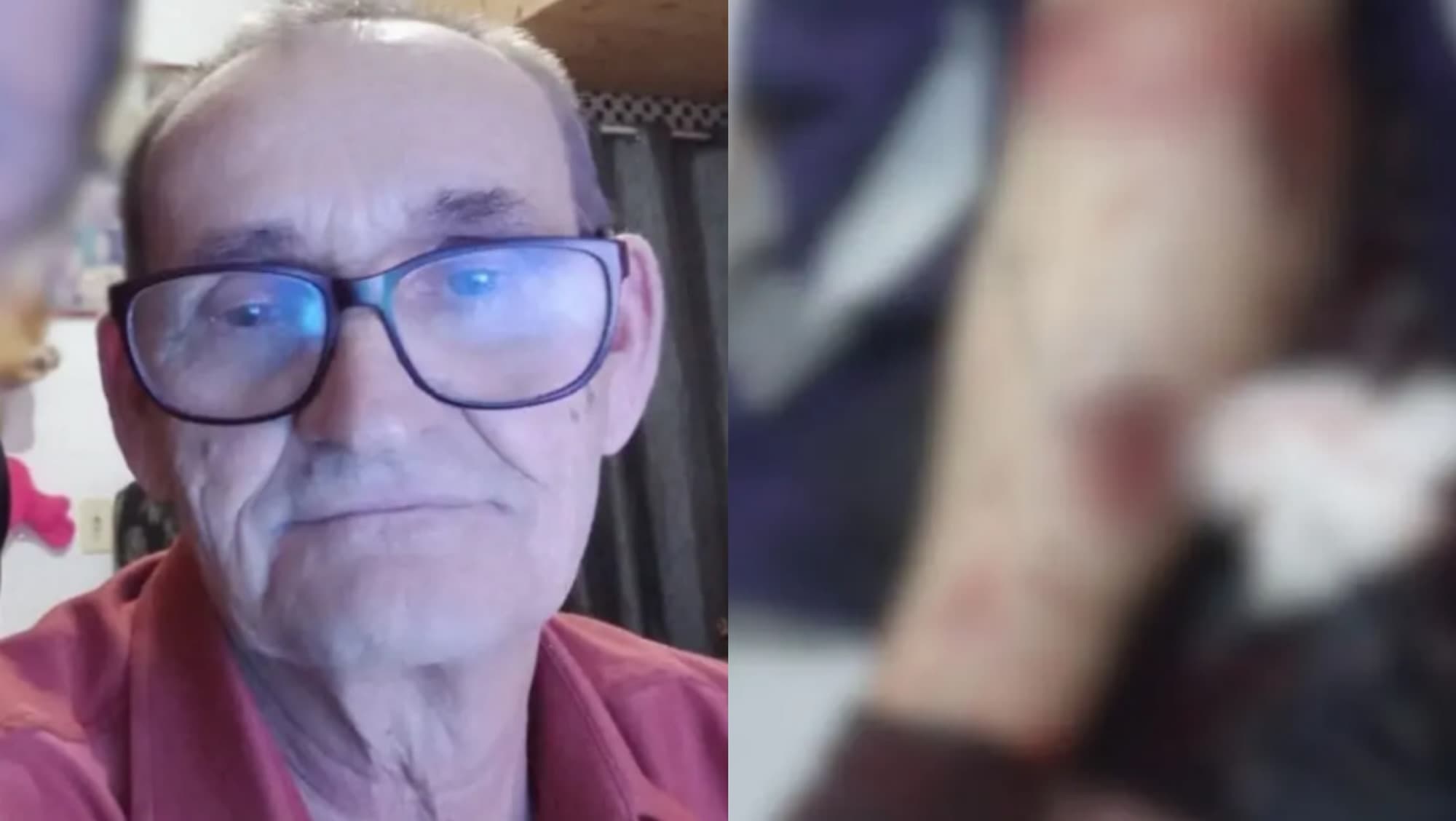 Leiturista da Celesc de 70 anos tem braço dilacerado por pit bull