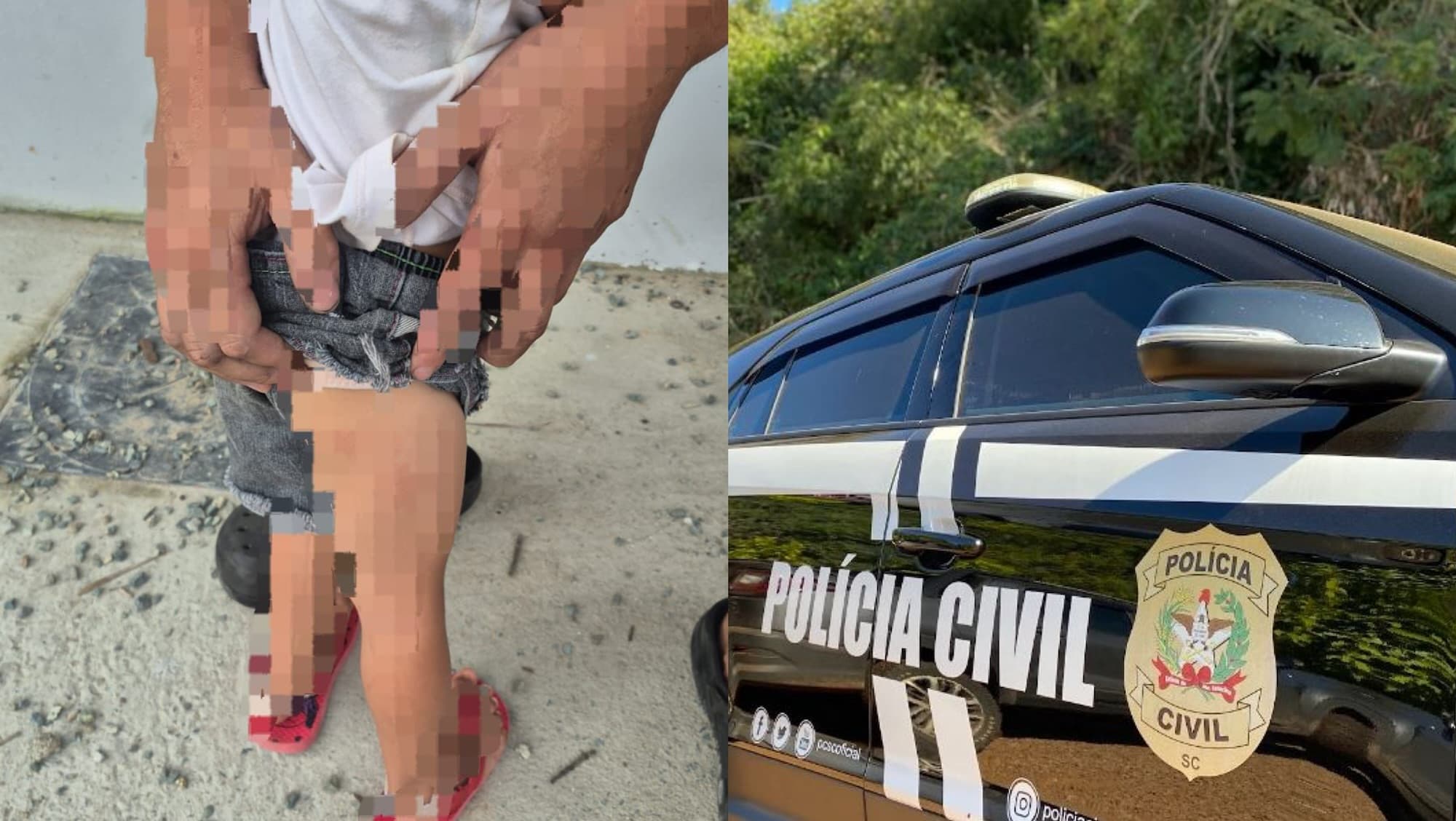 Mãe é presa por torturar menina de 3 anos e expor bebê nua nas redes sociais em SC: “filmou tudo”