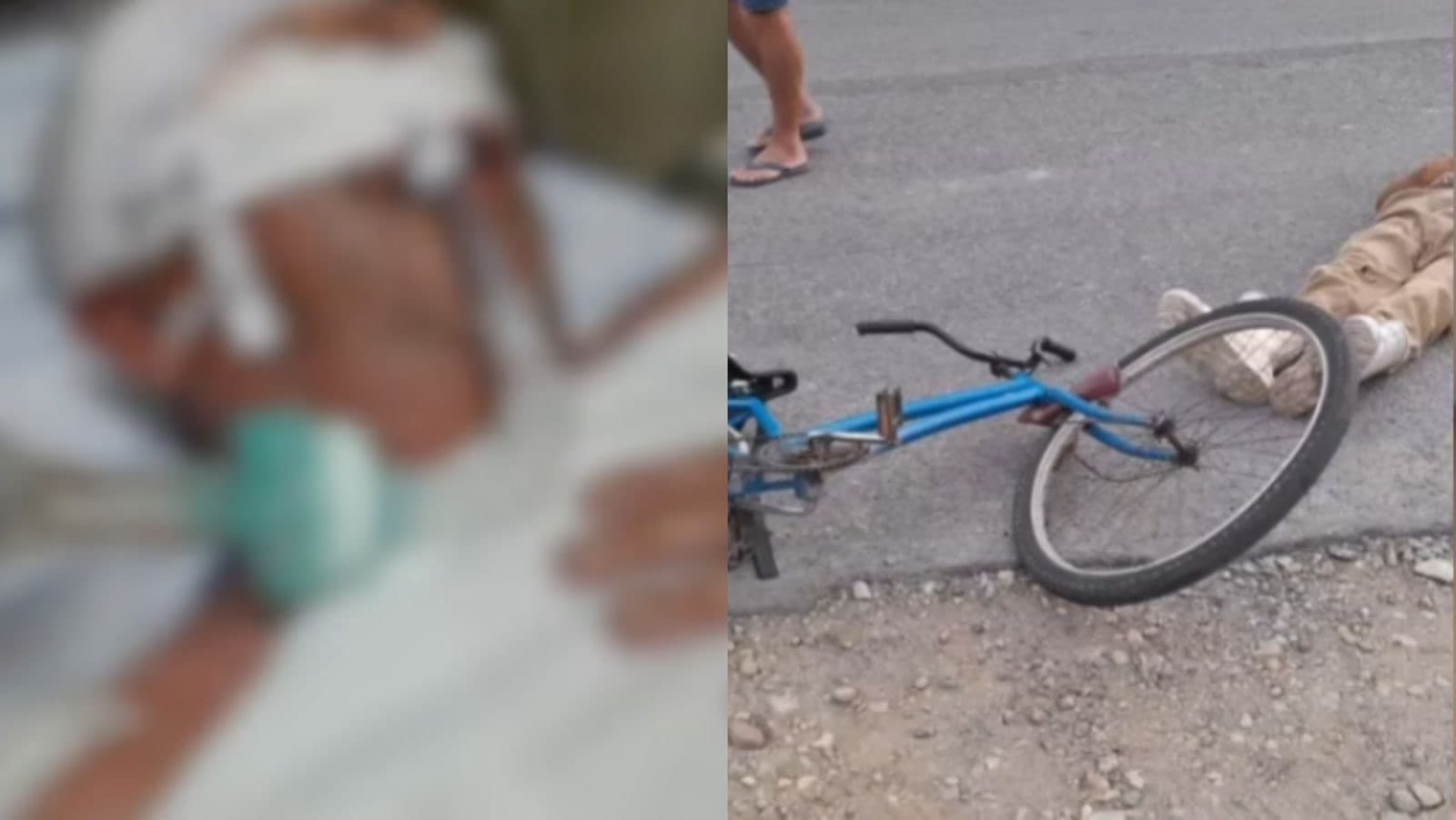 Idoso luta pela vida após ser atropelado por motorista bêbado em SC