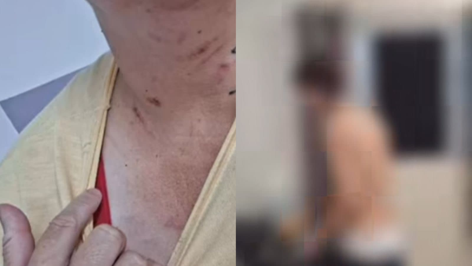 “Eu não merecia isso”: Mãe leva soco no rosto do filho após pedir ajuda para pagar o aluguel em SC