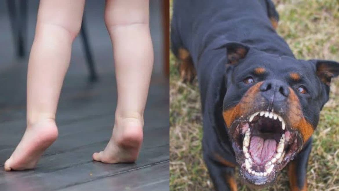 Criança de 4 anos fica gravemente ferida após ataque de rottweiler em Chapecó