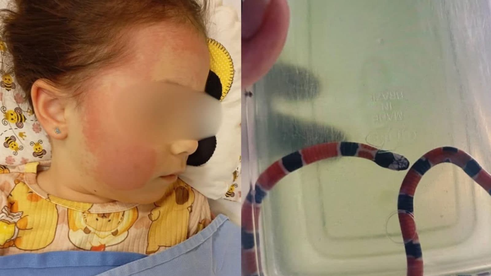“Achou que era minhoca”: criança escapa da morte após ser picada por cobra coral em Itajaí