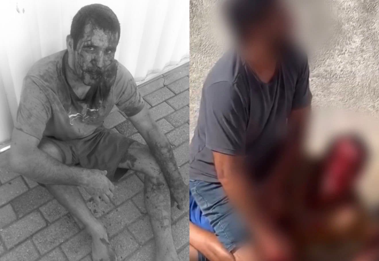 Ladrão “quebra a cara” após invadir casa para roubar em Tijucas: “caiu sozinho”