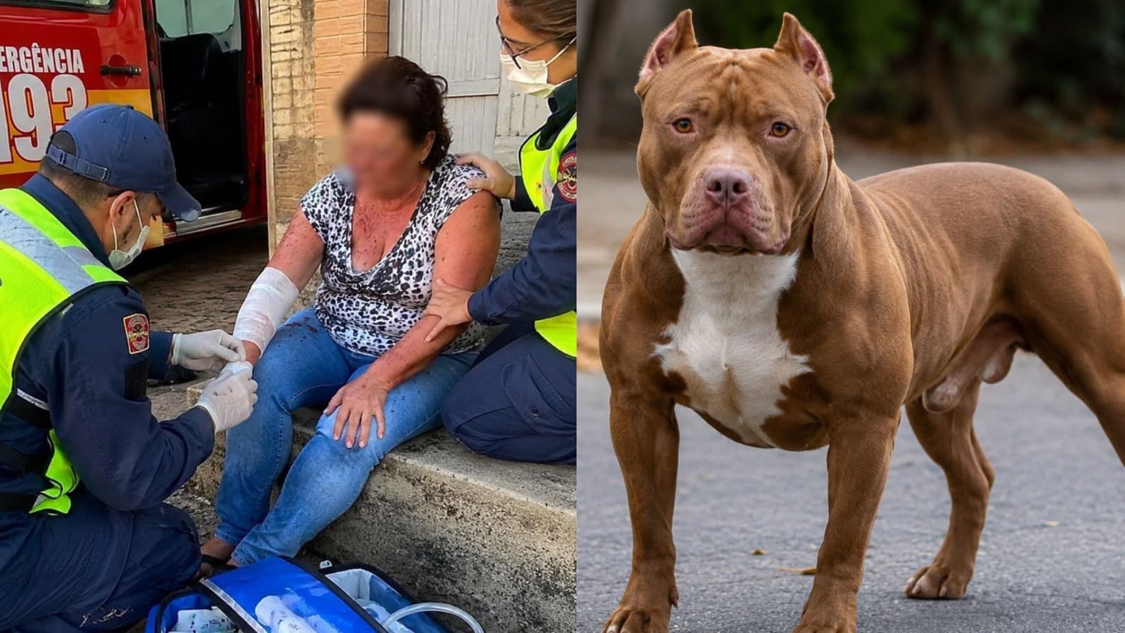 “Foi tudo muito rápido”: mulher fica ferida após ataque de pitbull em SC