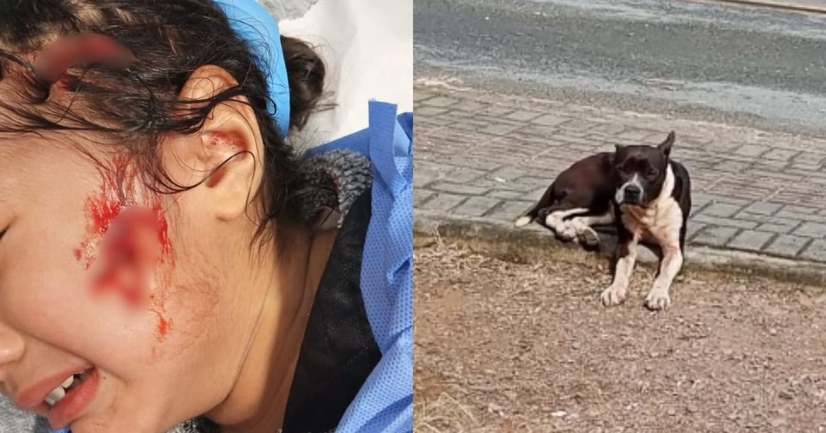 Cachorro ataca menina de 2 anos em Brusque; criança leva 15 pontos no rosto e na cabeça