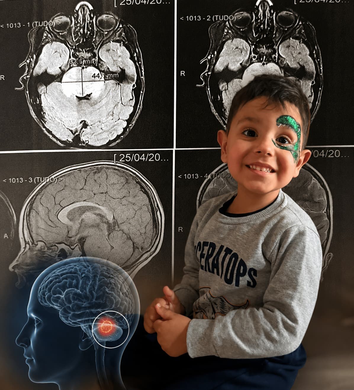 Pai ouve que o filho de 4 anos tem 14 semanas de vida e faz apelo em SC: “a gente tenta ser forte todos os dias”