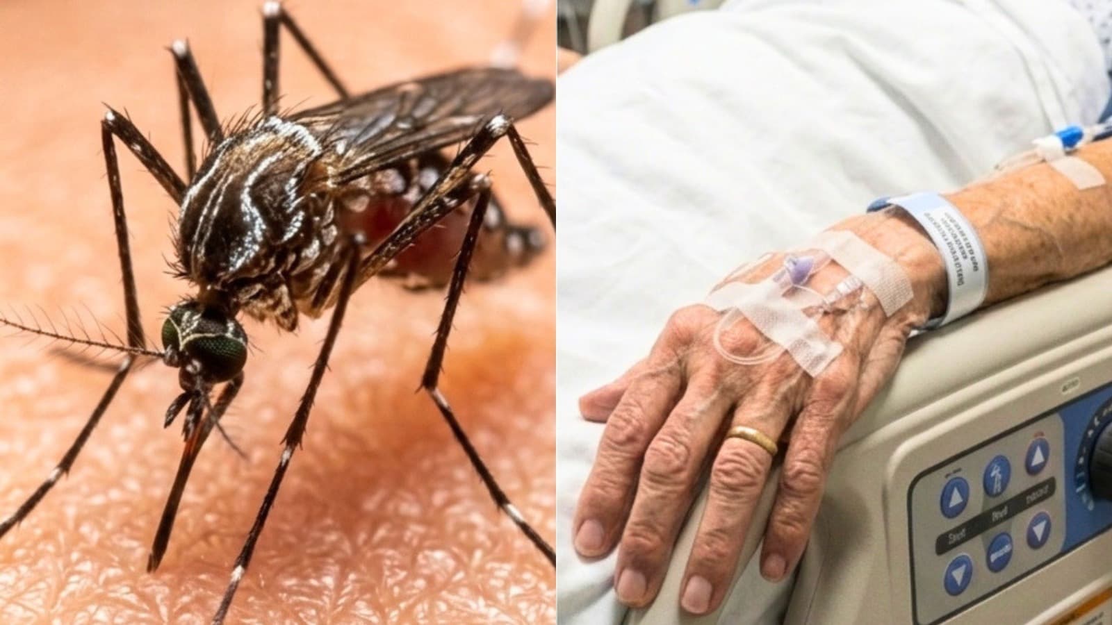 SC reforça vigilância contra Febre do Nilo Ocidental após confirmar 1ª morte por doença transmitida por mosquito