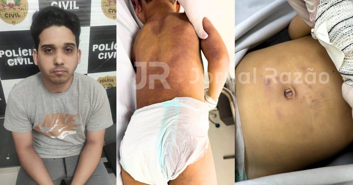 EXCLUSIVO: Marcas nas costas, mordida na bochecha, socos no abdômen: a morte cruel de Moisés em SC