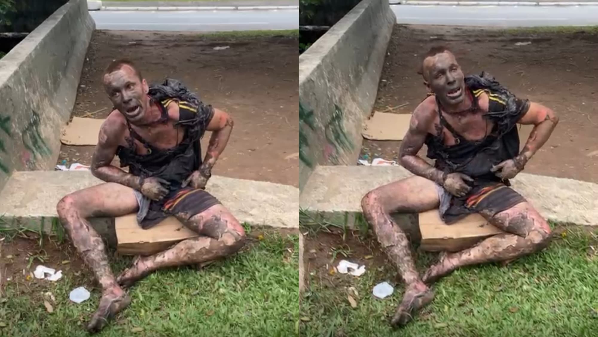 Morador de rua quase morre tentando furtar fios em Florianópolis: “chocante”