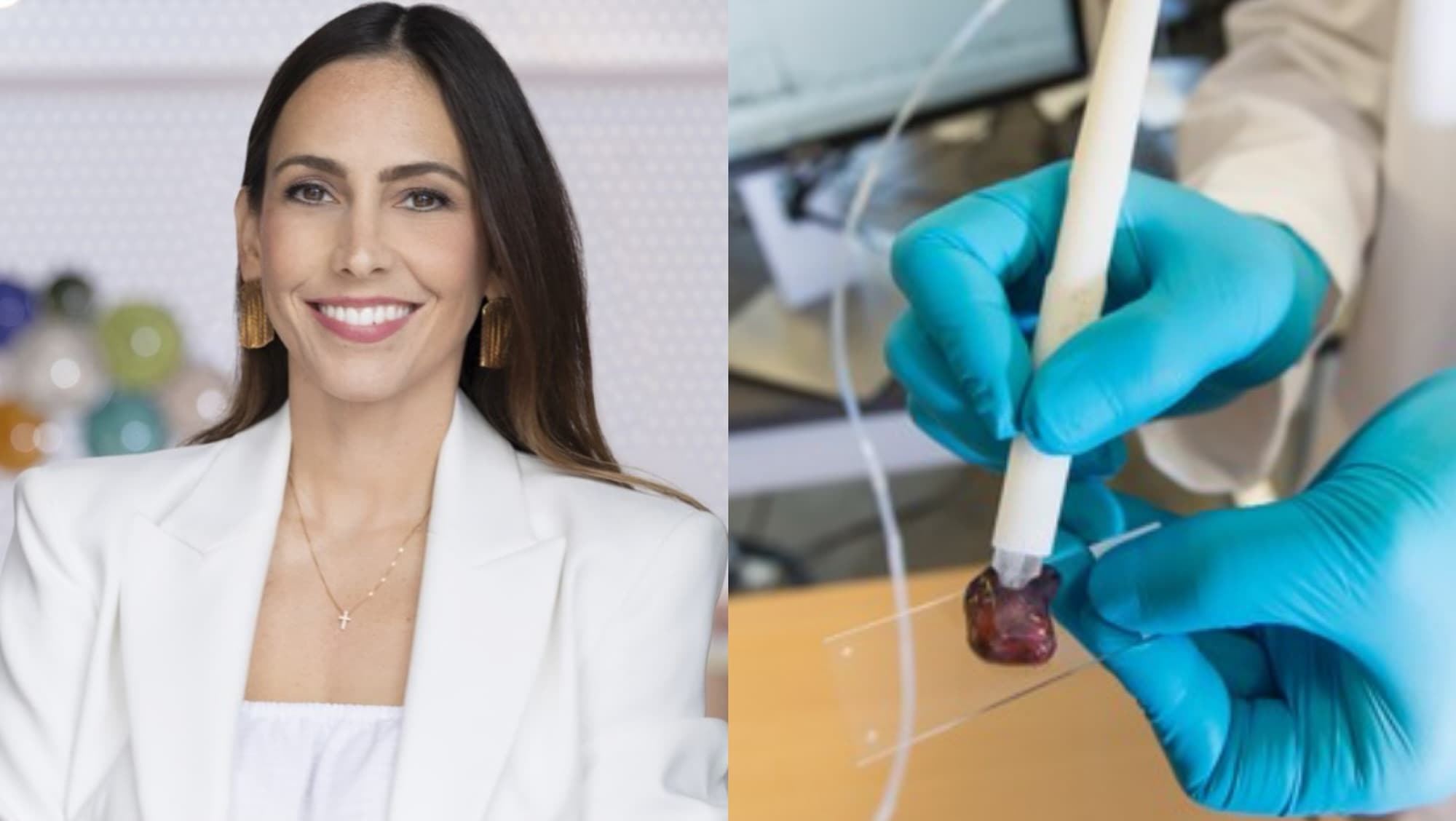 Pesquisadora brasileira cria caneta que detecta câncer em 10 segundos