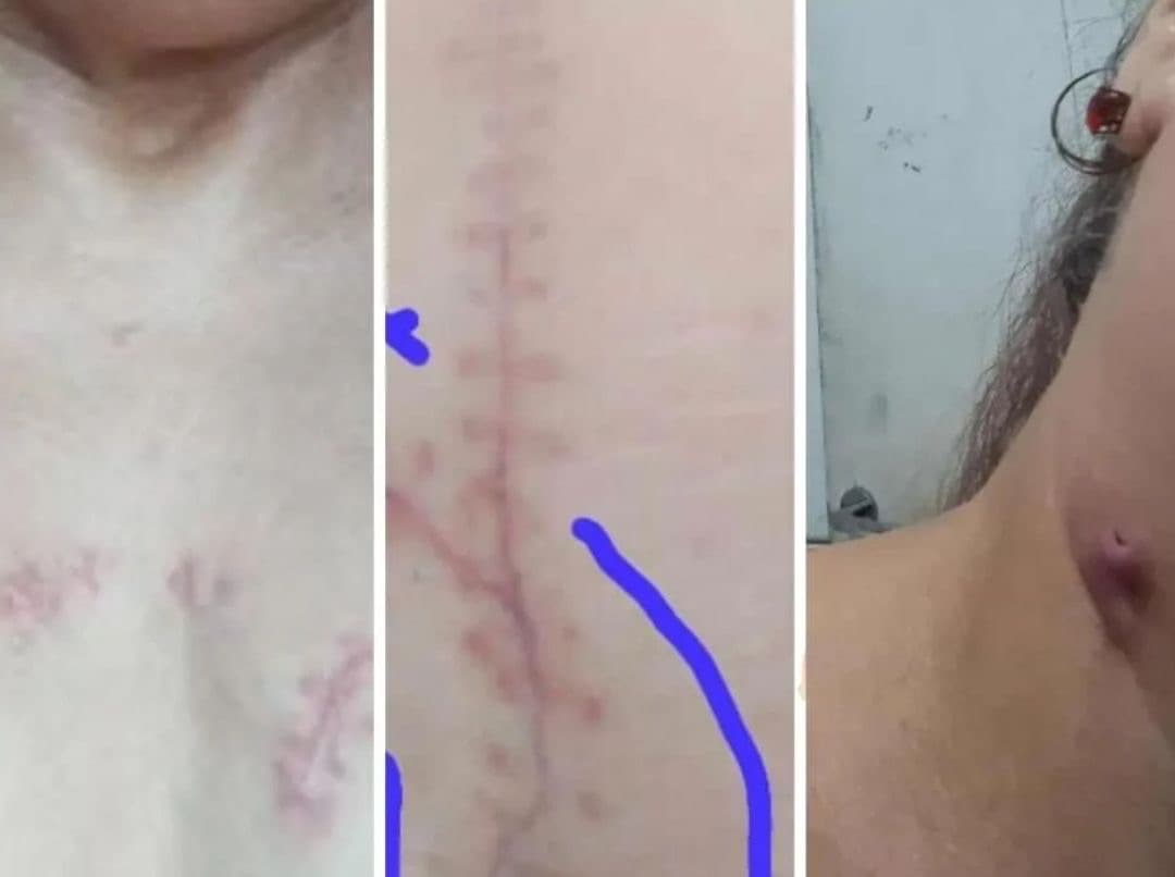 Homem que deu 54 facadas em mulher alega surto e sai do fórum pela porta da frente em Itapema