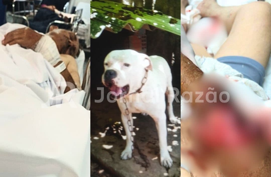 “O pit bull quase matou meu pai”, desabafa filho após idoso ser atacado enquanto trabalhava em Joinville