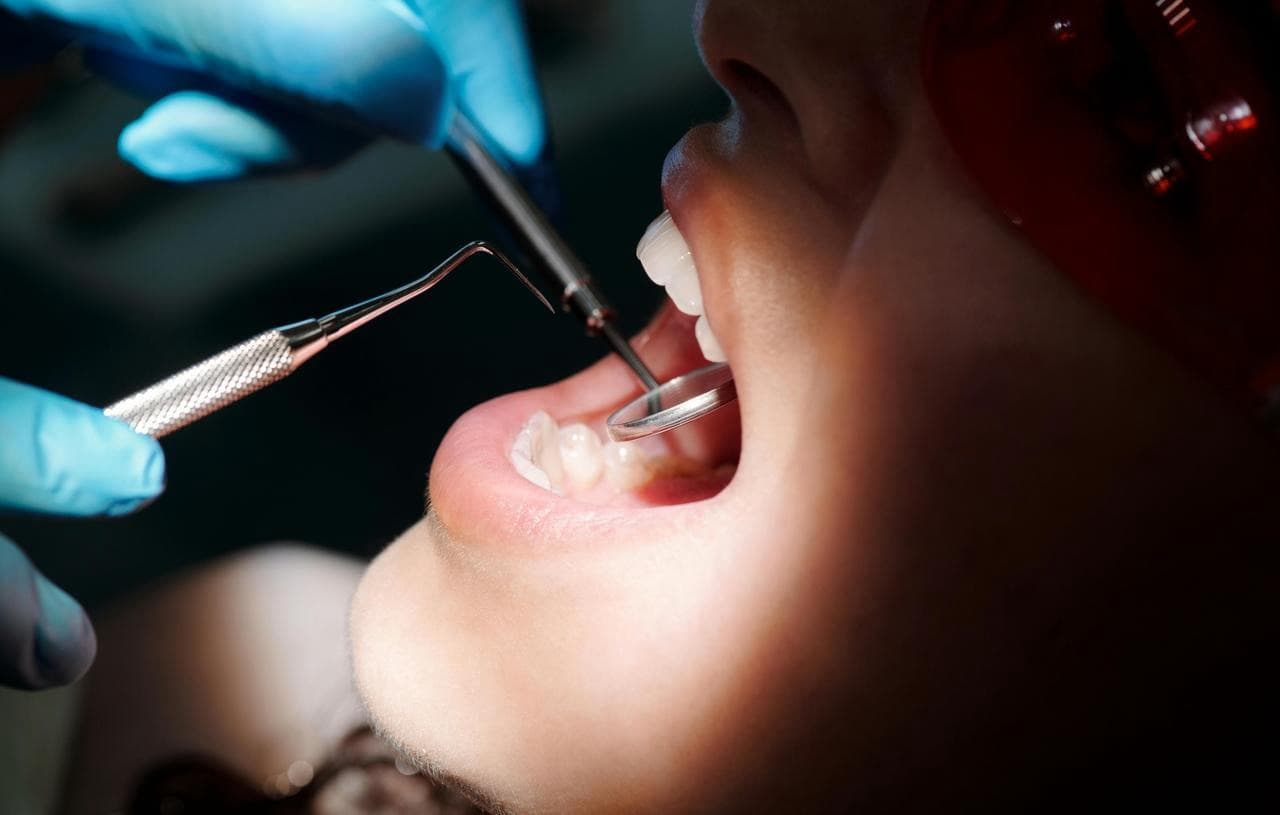 Dentista perde broca dentro da boca de paciente e é condenado a indenizar em SC