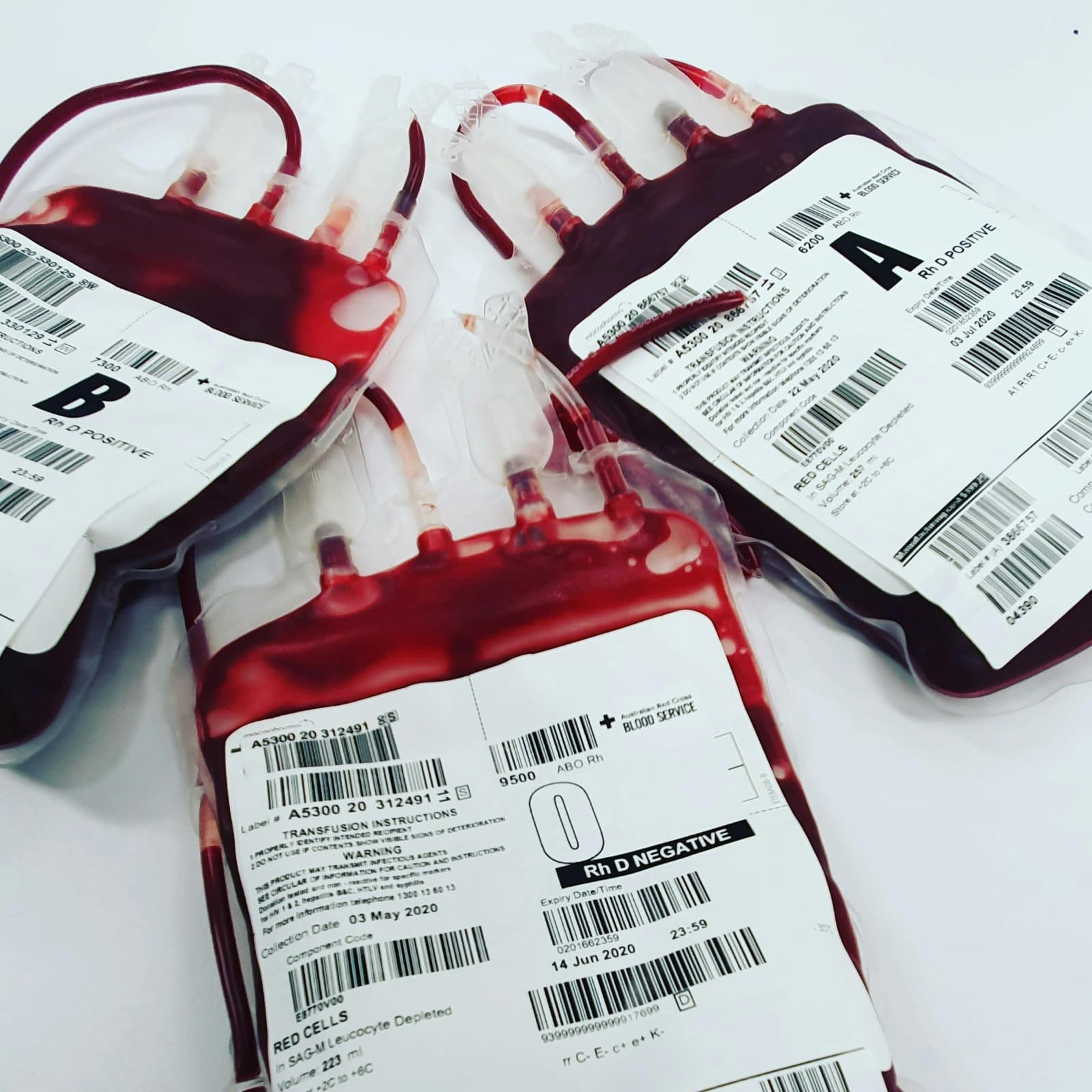 “Estoques críticos”: O negativo está em falta em SC, alerta Hemosc
