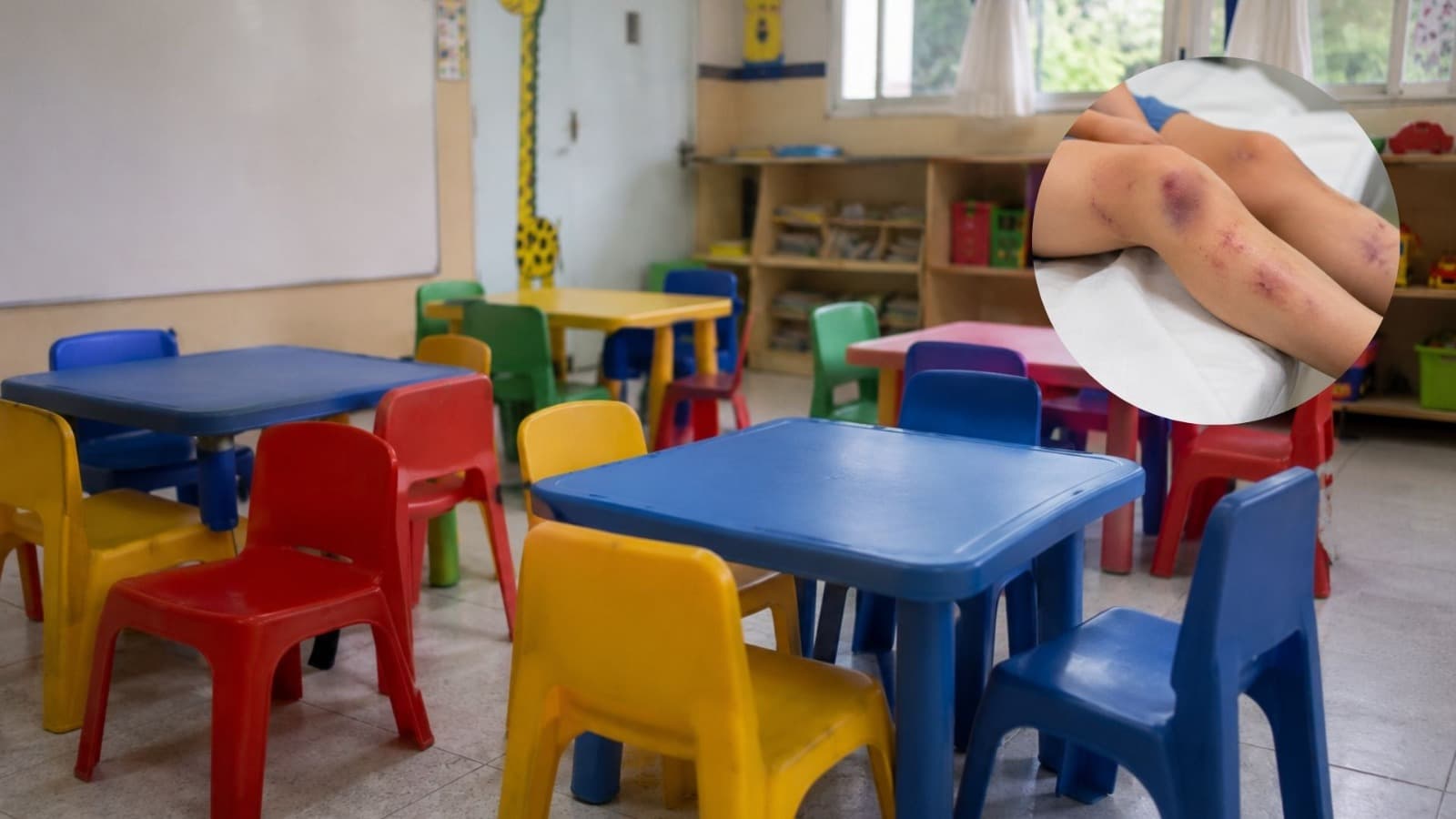 Professora é condenada após agredir criança autista de 4 anos que não queria dormir em creche de SC