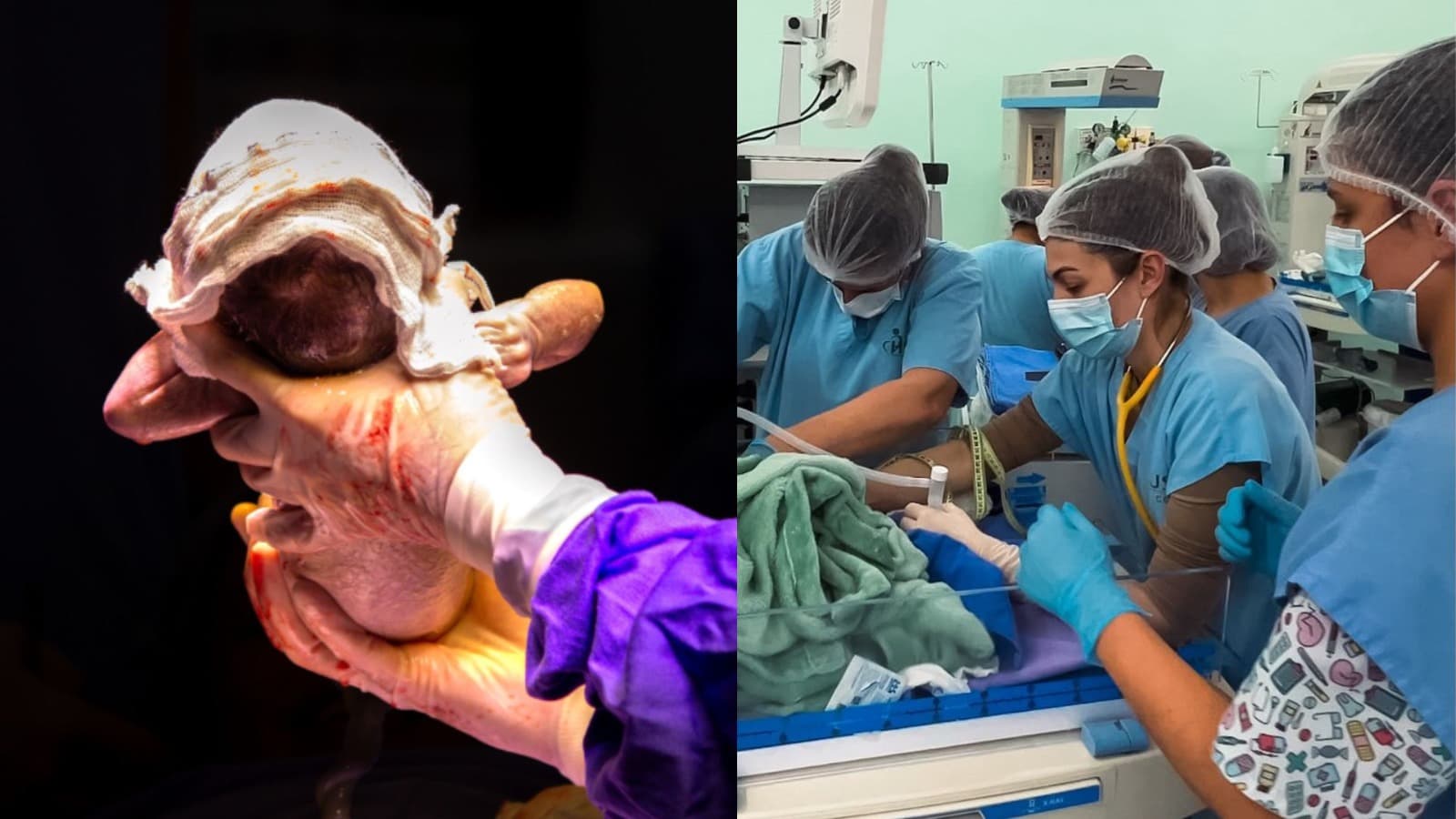 Após parto raro de trigêmeos, hospital de Joaçaba faz campanha para manter 20 leitos de UTI infantil