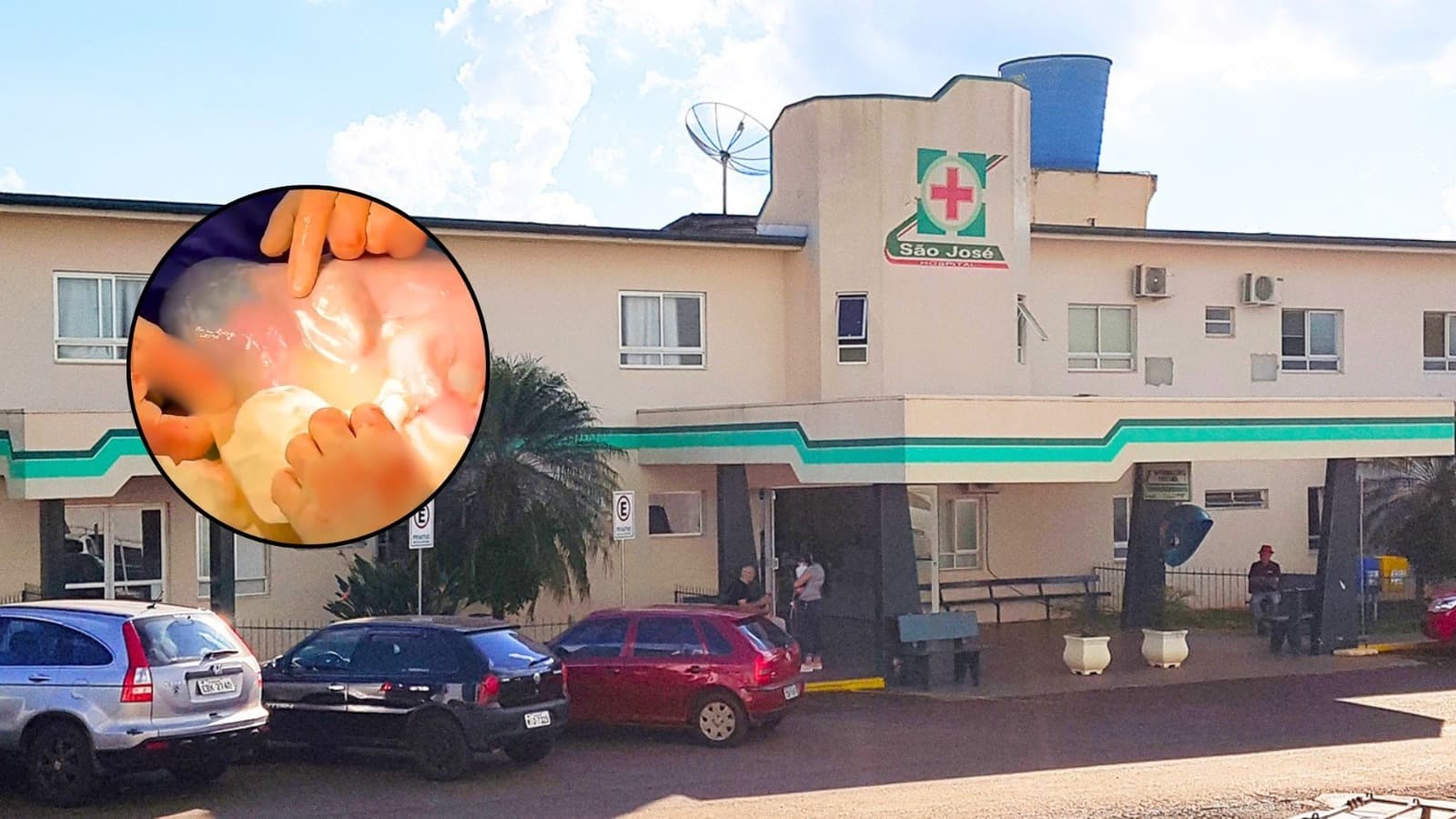 “Me emocionei”: parto de gêmeos em SC surpreende com cena raríssima e bebê nasce sem estourar a bolsa