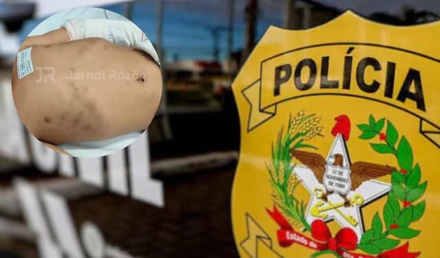 Menino de 2 anos morre e “mãe” e padrasto são indiciados em SC: lesões no cérebro desmentem “queda no banho”