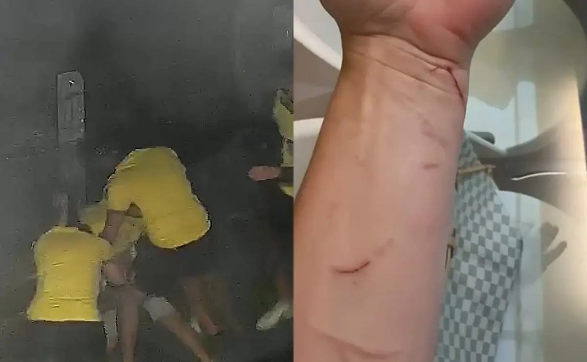Petista que diz ter sido espancado por assessor de Jair Renan em Florianópolis invadiu terreno após vitória de Lula